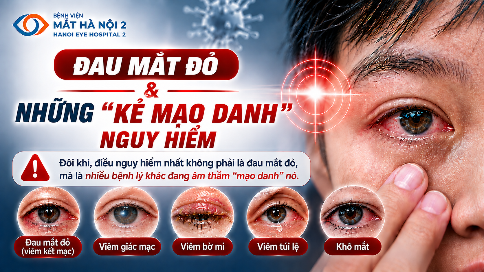 ĐAU MẮT ĐỎ VÀ NHỮNG KẺ 