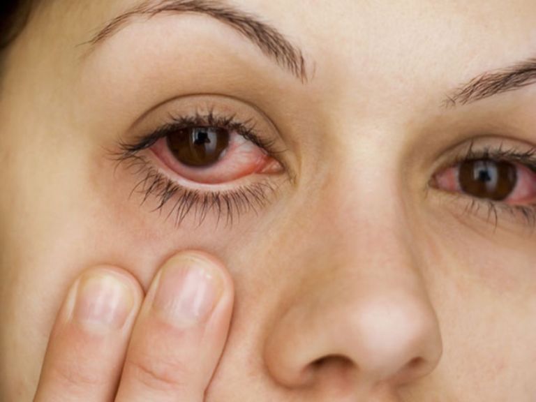 mức độ nguy hiểm của đau mắt đỏ