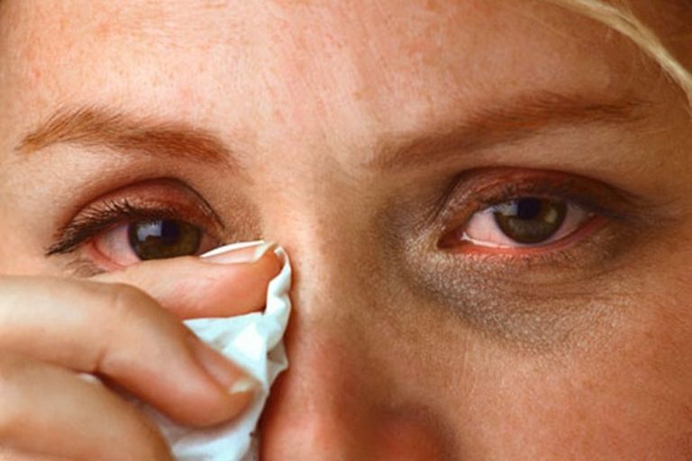 chăm sóc mắt đúng cách để ngăn ngừa đau mắt đỏ lây lan