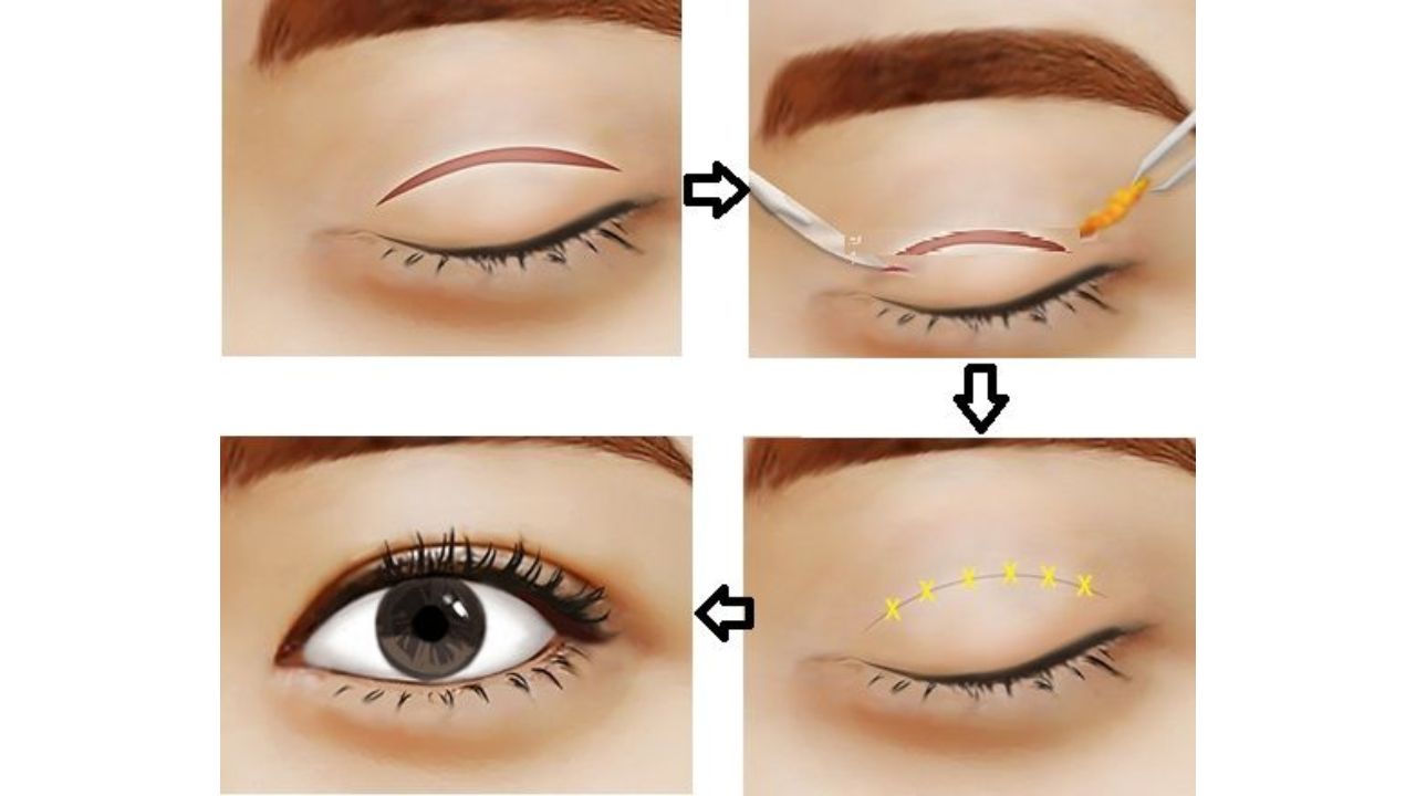 Phương ph&aacute;p gi&uacute;p bạn c&oacute; đ&ocirc;i mắt đẹp