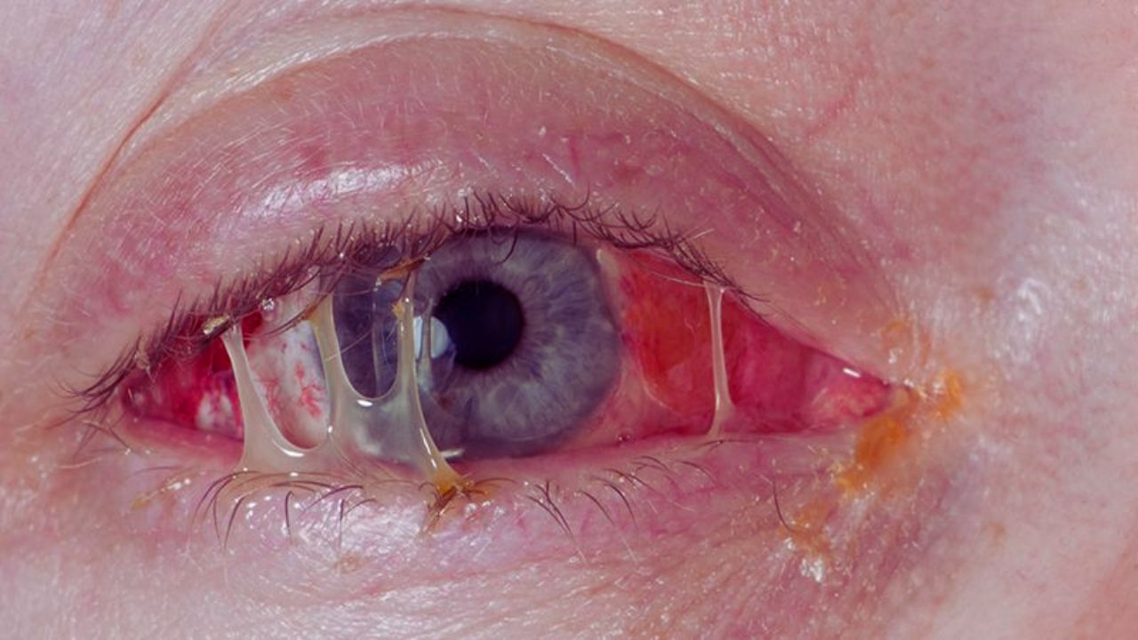 Những dấu hiệu bạn cần biết