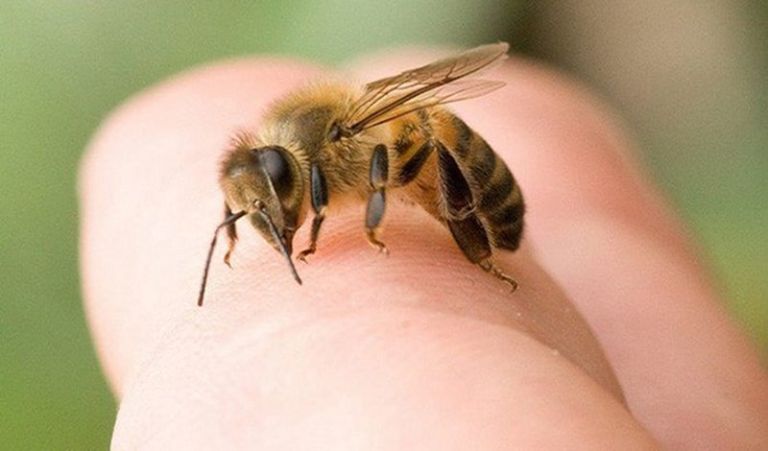 Bị ong đốt sưng mắt rất nguy hiểm