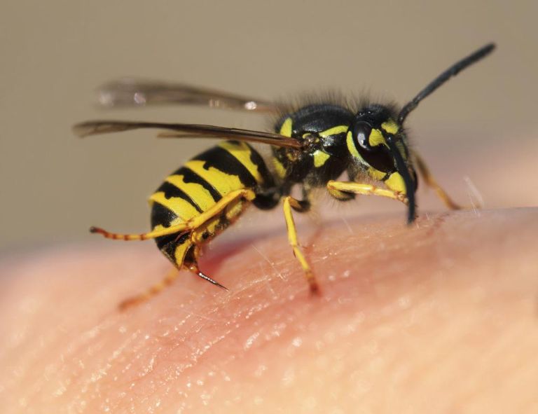 Bị ong đốt sưng mắt có nguy hiểm không?