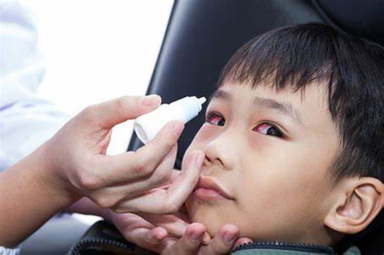 Dấu hiệu ở mắt nhận biết trẻ thiếu vitamin A