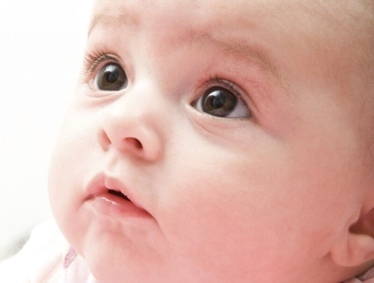 Nguyên nhân gây lác mắt ở trẻ sơ sinh