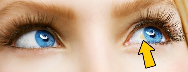 12Â Things Your Eyes Can Tell About Your Health
